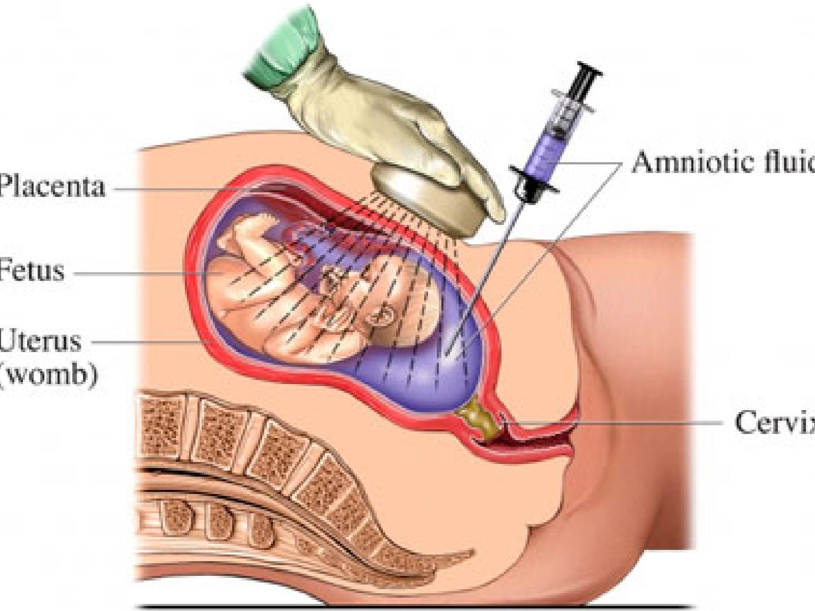 Fetal & Prenatal Diagnosis